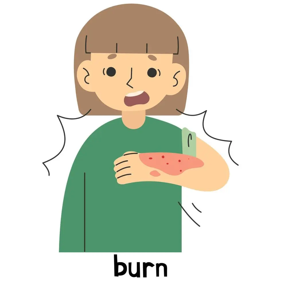 Burn classification