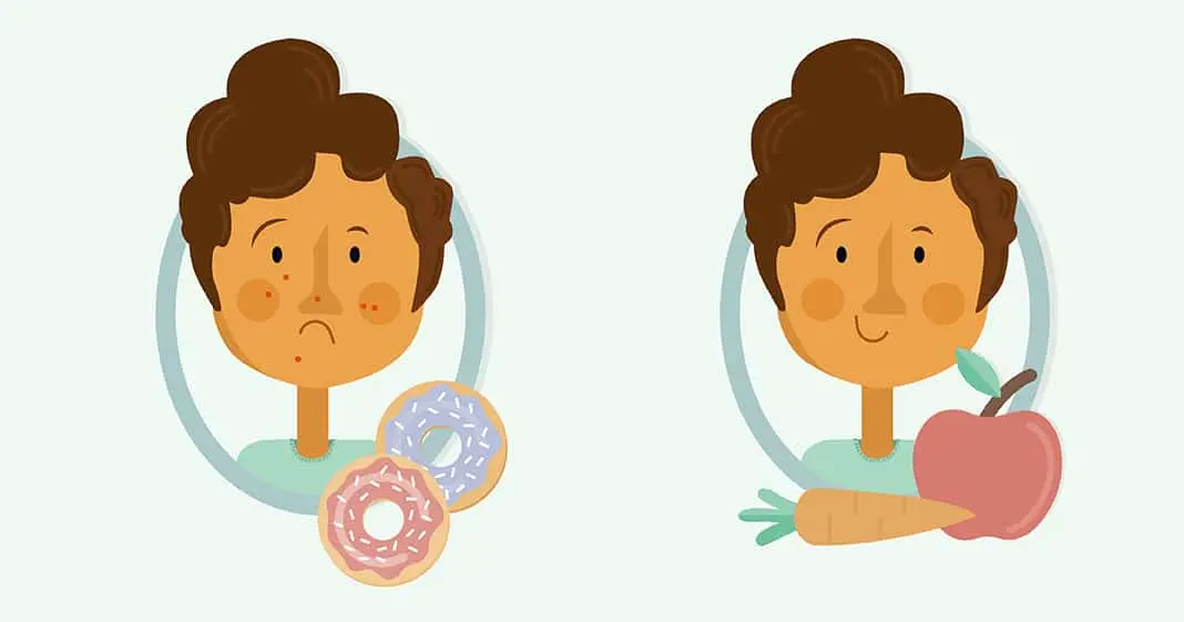 Healthy skin through lifestyle